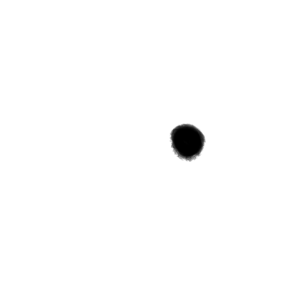 Right Eye